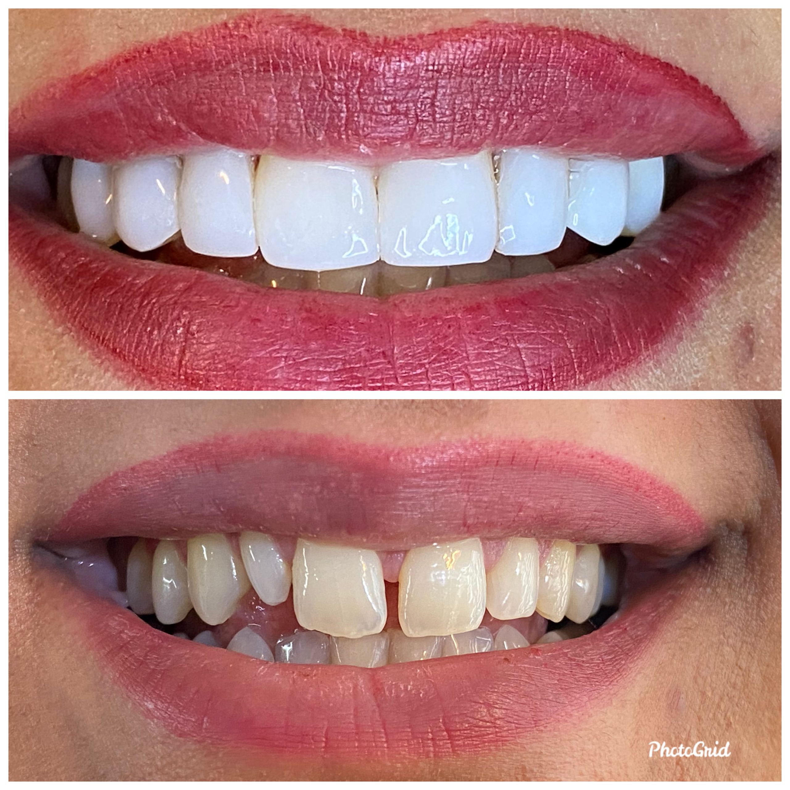 کار کلینیک دندانپزشکی پارسیان دنت 1 scaled
