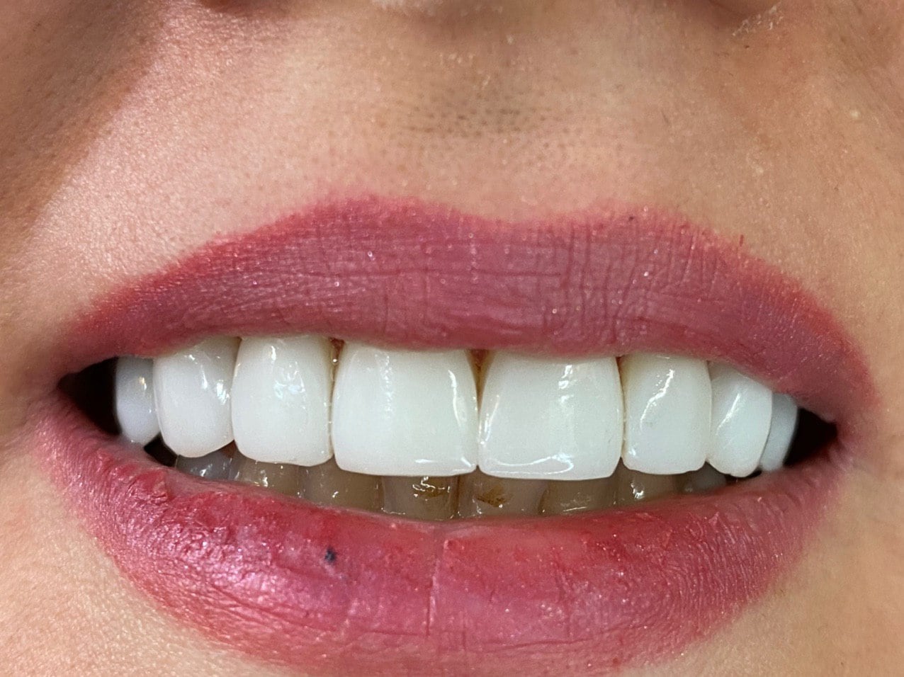 کار کلینیک دندانپزشکی پارسیان دنت 6