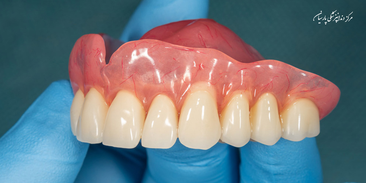 بایدها و نبایدهایی از دندان مصنوعی ژله ای که لازم است شما بدانید