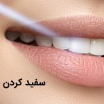 منظور از سفید کردن دندان با لیزر چیست و چگونه انجام میشود ؟
