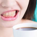 نوشیدن قهوه چه تاثیری بر تغییر رنگ دندان ها دارد ؟