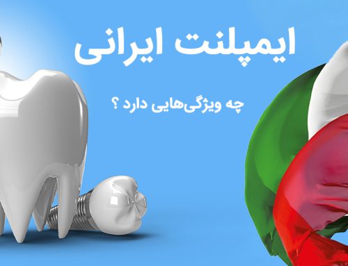 بهترین برندهای ایمپلنت ایرانی کدام است و چه ویژگی هایی دارد ؟